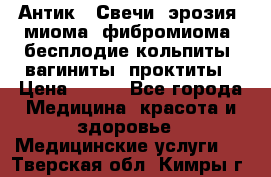 Антик.  Свечи (эрозия, миома, фибромиома, бесплодие,кольпиты, вагиниты, проктиты › Цена ­ 550 - Все города Медицина, красота и здоровье » Медицинские услуги   . Тверская обл.,Кимры г.